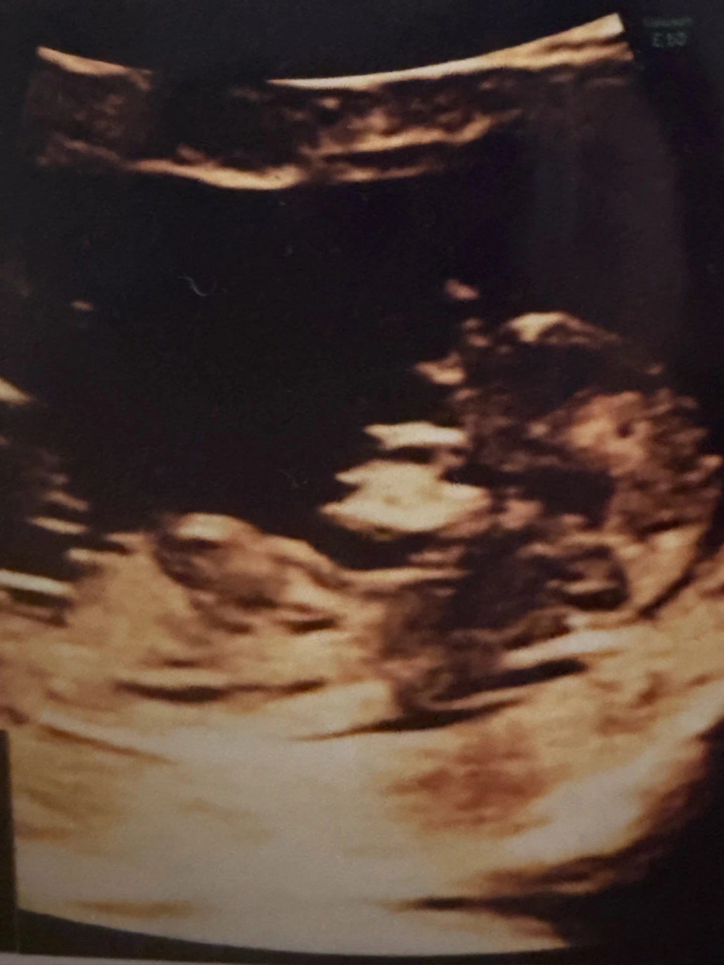 Supplied ultrasound image